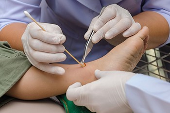 Why Patient Preference Matters in Foot Wound Care