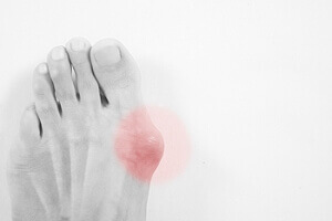 Athlete&#039;s Foot