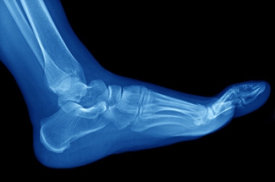 The Complex Anatomy of Your Feet and Ankles
