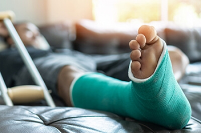Types of Bone Fractures