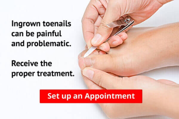 Plantar Fasciitis