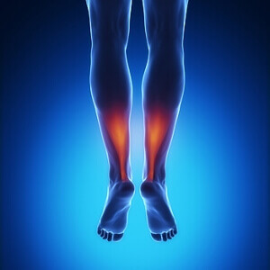 Women and Gout