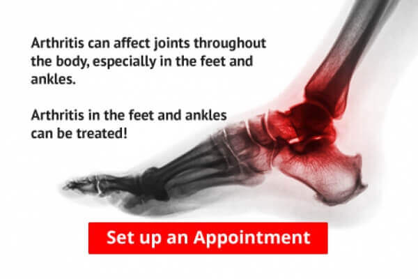 Falls Prevention